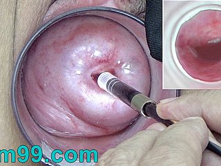Japanische Endoskop-Kamera innerhalb Cervix Cam on every side Vagina
